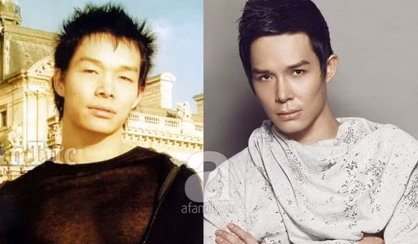 Ca sĩ Nathan Lee Không chỉ với vai trò người mẫu, Nathan Lee còn lấn sân sang ca hát. Và ở lĩnh vực nào, anh cũng gặp hái những thành công nhất định. Người hâm mộ ghi nhận những đóng góp của anh cho nghệ thuật cũng như ghi nhận những cố gắng anh làm cho mình đẹp hơn từng ngày. Nathan Lee sở hữu đôi mắt một mí, đậm chất châu Á, thế nhưng giờ đôi mắt ấy từ một mí chuyển thành hai mí khiến nhiều người đặt nghi vấn anh phẫu thuật thẩm mỹ. Chuyện phẫu thuật thẩm mỹ để đẹp hơn không còn là vấn đề lạ lẫm với giới nghệ sĩ. Ai cũng có nhu cầu tìm cái đẹp, thế nhưng, ta cần suy nghĩ kỹ trước khi quyết định thay đổi vẻ đẹp "trời cho". Bởi sau đó là những nụ cười hay nước mắt thì chưa ai biết có thể được khi lựa chọn phương án mạo hiểm.