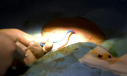 Can thiep qua da lay soi gan – mat