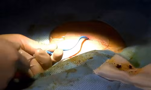 Can thiep qua da lay soi gan – mat