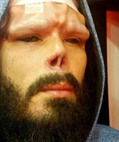 Henry đã trải qua rất nhiều đau đớn trong quá trình phẫu thuật