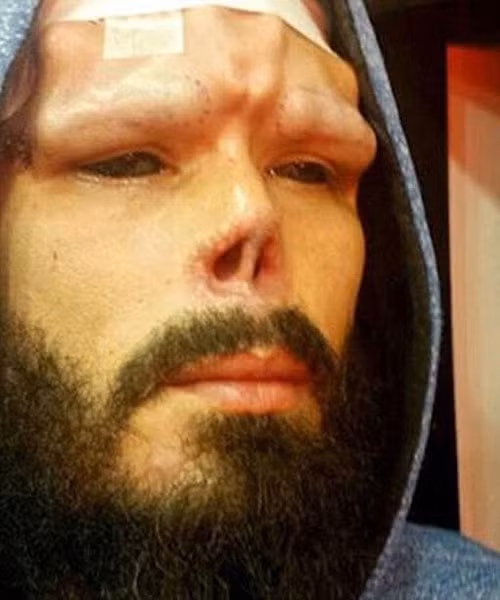 Henry đã trải qua rất nhiều đau đớn trong quá trình phẫu thuật