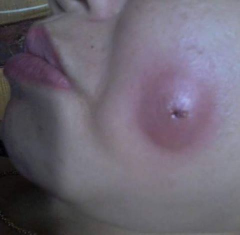 Mat sung vu vi lam ma lum dong tien gia re-Hinh-2