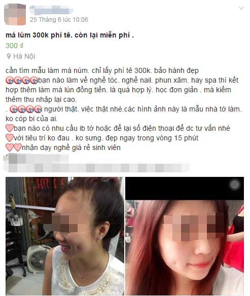 Mat sung vu vi lam ma lum dong tien gia re