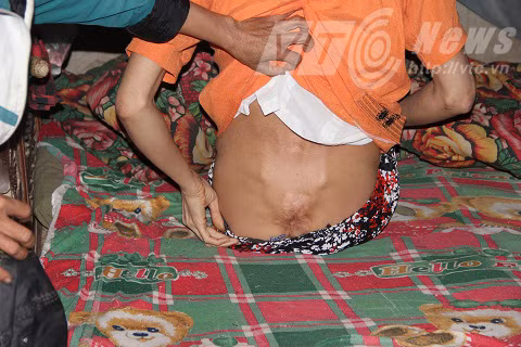 2 chi em lay chung chong o Ha Tinh: Niem hanh phuc la ky-Hinh-2