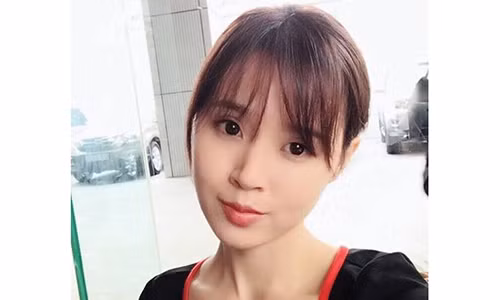 Midu khang dinh chua tung phau thuat tham my