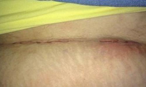 Hy huu: San phu dau de 36 tieng, mo bung khong thay con