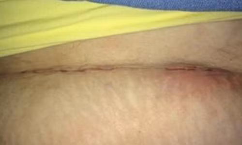 Hy huu: San phu dau de 36 tieng, mo bung khong thay con