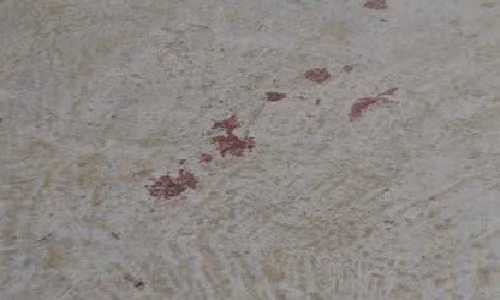 Da man em chong chem xoi xa vao chi dau