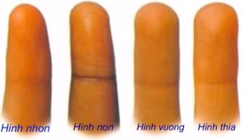 Hình dáng ngón tay của bạn là tròn, vuông hay nhọn? (Ảnh minh họa: Internet)
