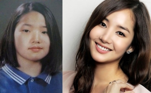 Park Min Young vốn sở hữu nhan sắc khá nhạt nhòa nếu không muốn nói là có hạn chế. Vì vậy, cô nàng đã nhờ cậy phẫu thuật thẩm mỹ để gọt hàm thon gọn hơn, nâng mũi cao và cắt 2 mí mắt để được hình ảnh xinh đẹp như hiện tại.