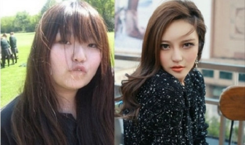 Người mẫu Châu Dương Thanh gây chú ý tại Đài Loan sau khi lột xác hoàn toàn. Nhìn hình ảnh hiện tại khó mà ngờ được cô gái này từng có ngoại hình kém ăn ảnh với gương mặt to, mũi tẹt, mắt xếch và miệng hơi vâu.