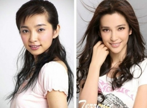 Lý Băng Băng cũng đã thành công trong phẫu thuật thẩm mỹ. Gò má tròn biến mất, cằm tròn cũng trở nên dài và nhọn hơn theo các chuẩn đẹp.