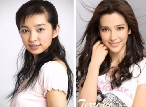 Lý Băng Băng cũng đã thành công trong phẫu thuật thẩm mỹ. Gò má tròn biến mất, cằm tròn cũng trở nên dài và nhọn hơn theo các chuẩn đẹp.