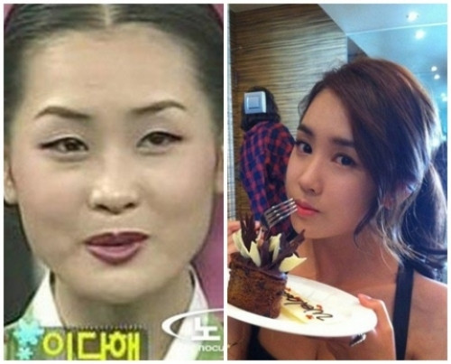 Lee Da Hae đã phẫu thuật thẩm mỹ nhiều tới mức còn được mệnh danh là "nữ hoàng dao kéo". Thay vì một khuôn mặt to kệch cỡm, hàm bạnh và đôi mắt 1 mí đặc trưng, hiện tại nữ diễn viên Châu Á có diện mạo hoàn hảo với chiếc cằm thon gọn và dài hơn, đôi mắt cũng to tròn hơn.