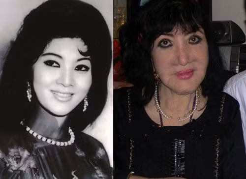 Thẩm Thúy Hằng không chỉ nổi tiếng bởi tham gia rất nhiều bộ phim mà còn từng là biểu tượng nhan sắc phụ nữ một thời. Tuy nhiên do chưa hài lòng với nhan sắc của mình, cô đã thường xuyên sử dụng phương pháp tiêm botox để làm căng da mặt. Và hậu quả là khuôn mặt đã bị biến đổi kinh hoàng.