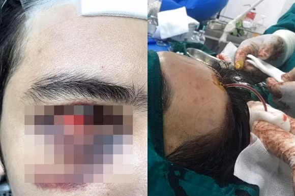 Hotboy bi tu huyet sung phu mat vi phau thuat tham my rom