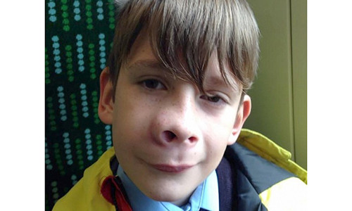 Tưởng vết muỗi đốt nhưng thực chất là khối u lạ nguy hiểm đến tính mạng.