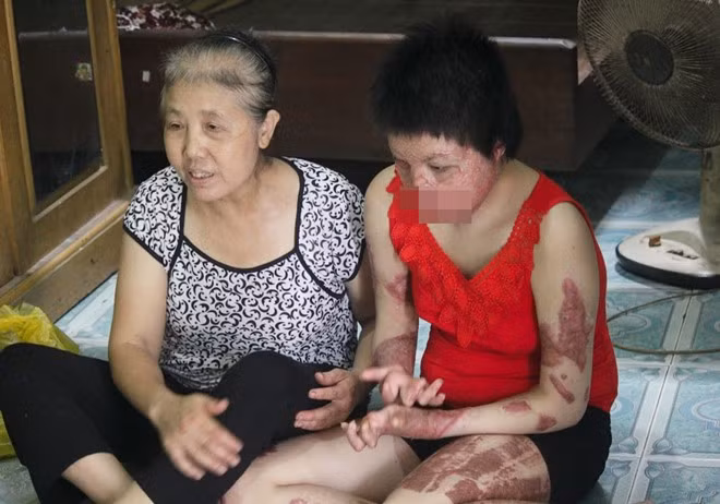 Bà Duyên luôn bên cạnh chăm sóc con gái. Ảnh: Quang Anh.