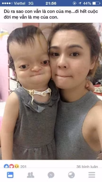 Bức ảnh có sự đối lập giữa người mẹ trẻ xinh đẹp bên đứa con tật nguyền kèm dòng cảm xúc: "Dù sao con vẫn là con của mẹ. Đi hết cuộc đời mẹ vẫn là mẹ của con" khiến nhiều người xúc động.