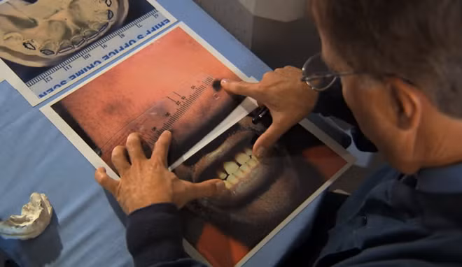 Chuyên gia nha khoa kết luận hàm răng thưa của Lucious trùng khớp với vết cắn trên cánh tay phải của Dawnia. Các móng tay của nạn nhân cũng chứa DNA của Lucious.