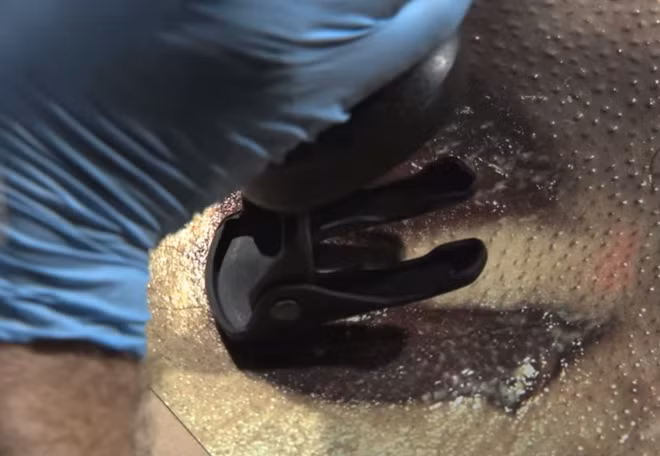 Linh mục của nhà thờ cho biết, một cưa thụt và một tuốc nơ vít 5 cạnh biến mất. Kết quả đối chiếu cho thấy đầu cưa thụt chính là vật gây nên vết thương hình móng ngựa trên đầu nạn nhân.