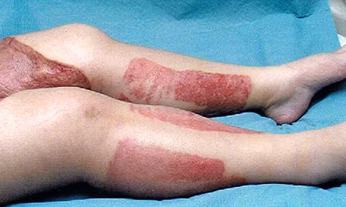 Hon me, chan hoai tu vi cao long vung kin