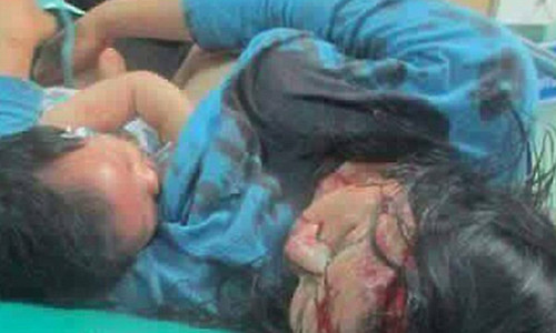 Xuc dong canh me gay chan tay van co cho con bu