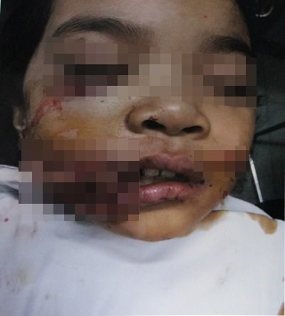 Bi cho can nat mat, be gai phai khau 200 mui