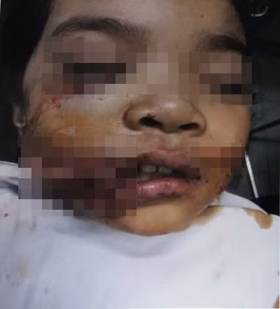 Bi cho can nat mat, be gai phai khau 200 mui