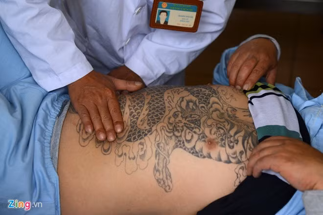 Do đó, bên cạnh việc điều trị bệnh lý, các bác sĩ còn phải điều trị tâm lý cho bệnh nhân.