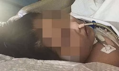 Dung rang mo nap chai hoa qua ngam, hau qua khon luong