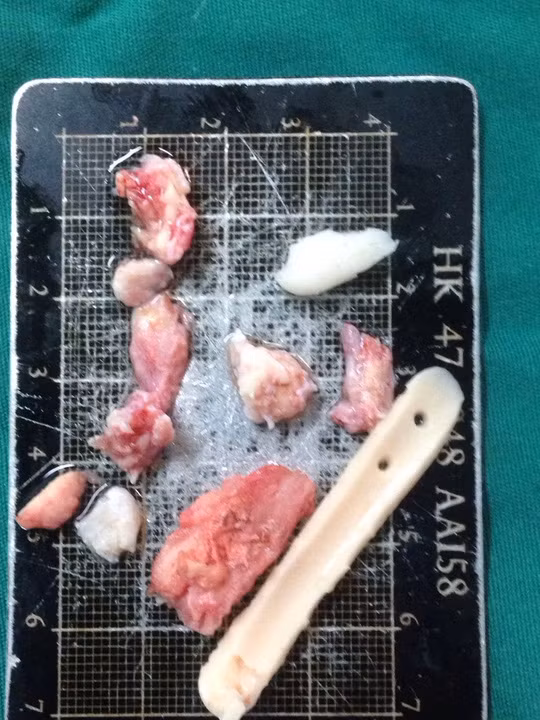 10 nam tho bang mieng do 6 lan nang mui-Hinh-2