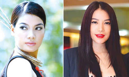 My nhan Viet thay doi chong mat sau phau thuat tham my