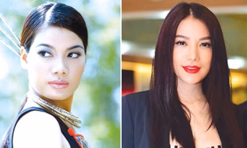 My nhan Viet thay doi chong mat sau phau thuat tham my