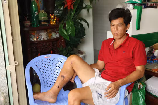 Ông Phong, chủ xe khách đã bị chấn thương sau vụ tai nạn nói trên.