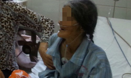 Choang vang khi boc lop da bi chai duoi got chan bi hoai tu