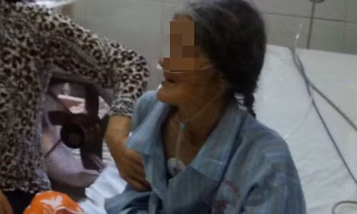 Choang vang khi boc lop da bi chai duoi got chan bi hoai tu