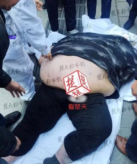 Ngày 13.2, anh được ra viện nhưng trên đường đi bộ tới nơi đậu taxi, Hoàng bị trượt chân ngã và không thể đứng dậy. Mẹ anh phải gọi cứu hộ trong khi đám đông vây quanh giúp anh đứng dậy. Nhân viên cứu hộ thậm chí phải mang theo bình oxy để giúp Hoàng thở bình thường.