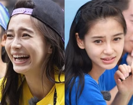 Angelababy có một khuôn mặt đẹp hoàn hảo, vì thế cả fan và antifan đều nghi ngờ cô nàng đã phẫu thuật thẩm mỹ. Trong show thực tế Running man bản Trung, Angelababy từng để lộ phần cằm dưới nhô ra rõ rệt khi cười. Phần cằm của cô lúc đó giống hệt đã được độn thẩm mỹ, nhưng Angelababy một mực đòi tới bệnh viện để kiểm tra, chứng minh sự trong sạch. Vậy rốt cuộc, ai mới là người nói dối?