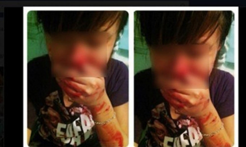 Phan cam gai tre tu “giet minh” bang nhung tro cau like rung minh