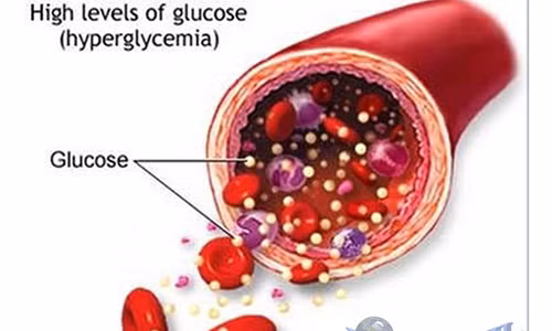 Cảnh giác hạ đường huyết khi trời nắng nóng.