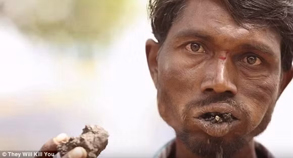 7. PICA Người mắc bệnh này luôn thèm ăn những thứ không phải là thức ăn nhưng không thể cưỡng lại được. Người bị bệnh này có thể ăn bất cứ thứ gì như giấy và gỗ, sơn, chì thậm chí là phân hoặc nước tiểu. Một người đàn ông mắc bệnh này đã được tìm thấy hơn 1.400 thứ khác nhau trong dạ dày của anh ta. Hội chứng Pica bắt nguồn từ tiếng La tinh dùng để gọi một loài chim có tên là Magpie. Đây là loài chim ăn tạp, chúng có thể ăn bất kỳ thứ gì.