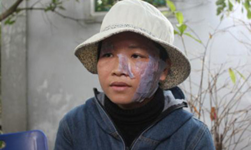 Vu chong la chay mat vo: Ai oan noi dau tu ban hang da cap