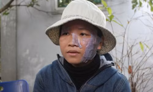 Vu chong la chay mat vo: Ai oan noi dau tu ban hang da cap