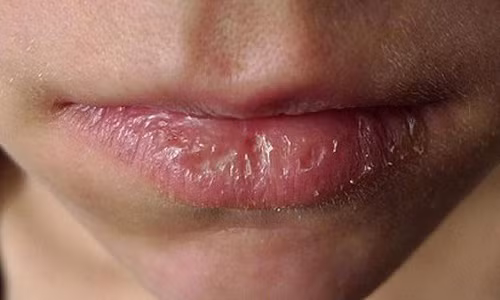 Hong moi vi dung son qua dam mau