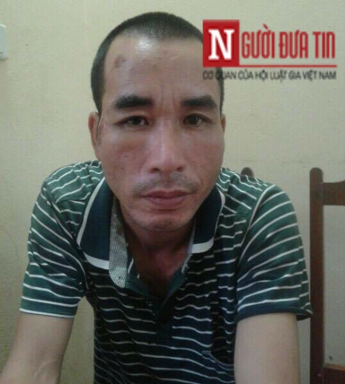 2 thanh nien trom cho “that thu” truoc ba lao U60