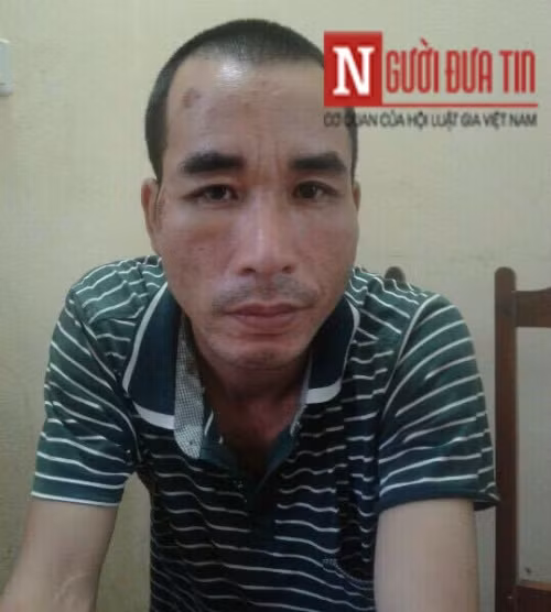 2 thanh nien trom cho “that thu” truoc ba lao U60