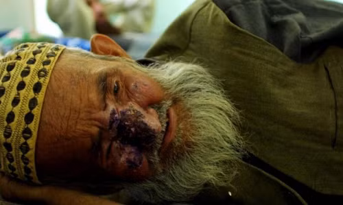 Soc: Benh “an thit nguoi” lan tran khap Trung Dong