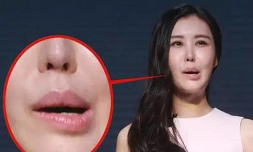 Nguoi co 1 trong 5 tuong mao nay, khong nen ket tham giao