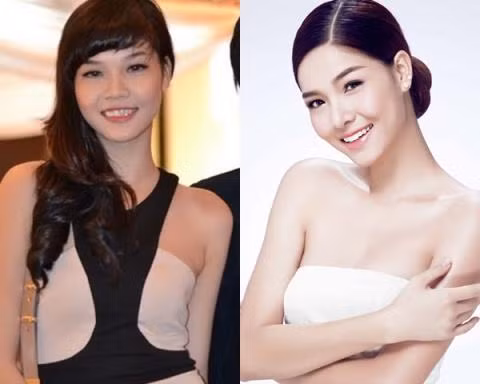 Chân dài Kỳ Hân thực sự đổi khác so với quá khứ. Hai bức hình của Kỳ Hân khác nhau về mọi nét trên gương mặt. Cô cũng không ngại thừa nhận bản thân đã "dao kéo" để mình đẹp lên.